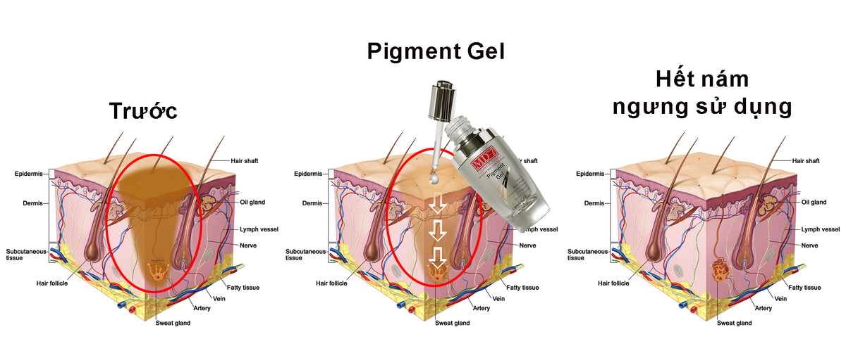 Advanced Pigment Gel (APG) – MD-7 Cosmeceuticals