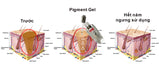 Advanced Pigment Gel (APG)